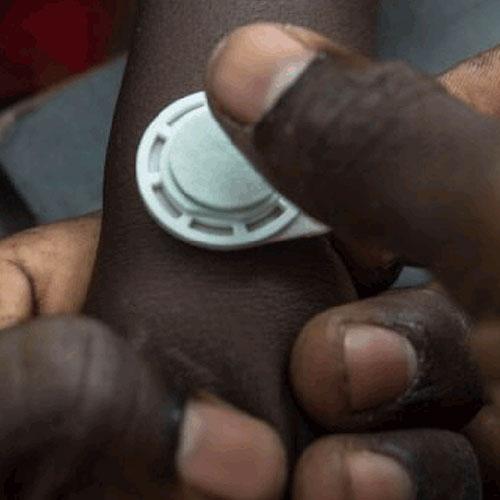 The Button to Health: Micron Biomedical’s Game-Changing Vaccine Technology
